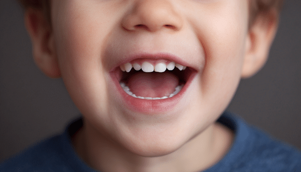 Boca de un niño por mordida abierta por chupón. El niño tiene aproximadamente 2 años de edad y solo se ve la mitad de su rostro incluyendo su nariz, mejillas, orejas, boca, barbilla y cuello.
